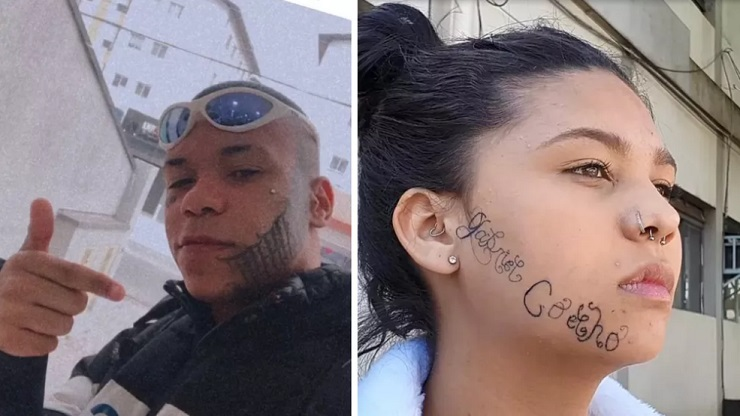 Jovem inicia processo de remoção de tatuagem feita em seu rosto por ex-namorado 