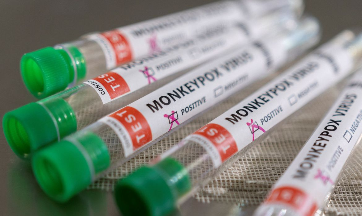 Minas Gerais atinge a marca de 100 casos positivos de Monkeypox