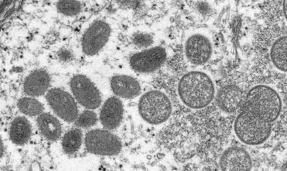 Ministério da Saúde confirma 76 casos de varíola dos macacos no Brasil