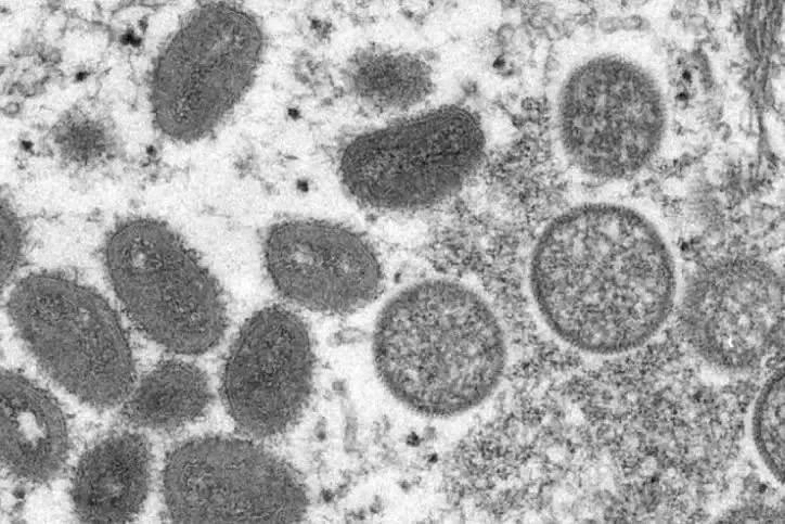 Vírus foi relatado em 4 países
