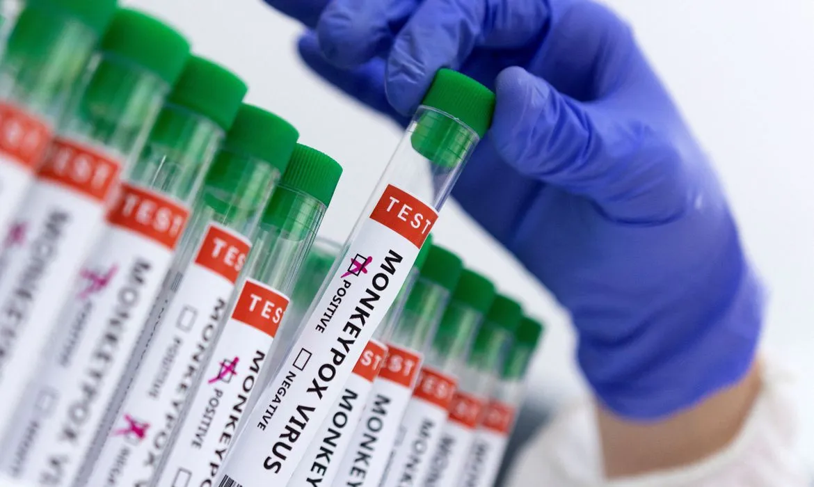 Brasil tem 813 casos de varíola do macaco; OMS diz que situação é preocupante