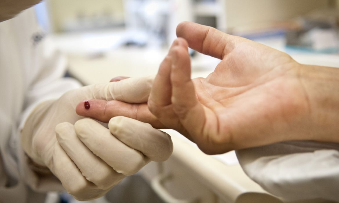 "Avançamos na ciência, mas não no diálogo", destaca infectologista sobre AIDS