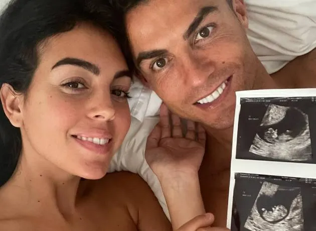 Cristiano Ronaldo e Georgina exibem exame de imagem que revelou a gravidez de gêmeos