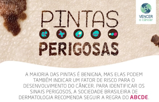 Algumas pintas podem indicar fator de risco para o câncer de pele Instituto Vencer o Câncer