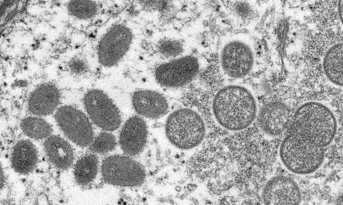 OMS classificou a varíola dos macacos como emergência de saúde pública Reprodução/CDC