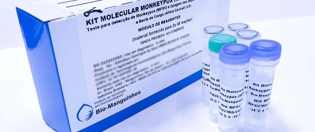 Varíola dos Macacos: Fiocruz pede registro de kit de diagnóstico da monkeypox