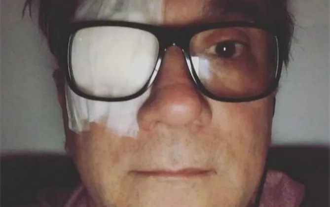 Bruno Gouveia aparece de curativo no olho após cirurgia