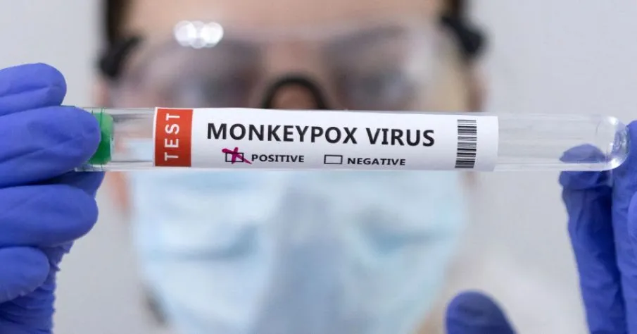 Primeiro óbito por Monkeypox foi registrado em Minas Gerais. 