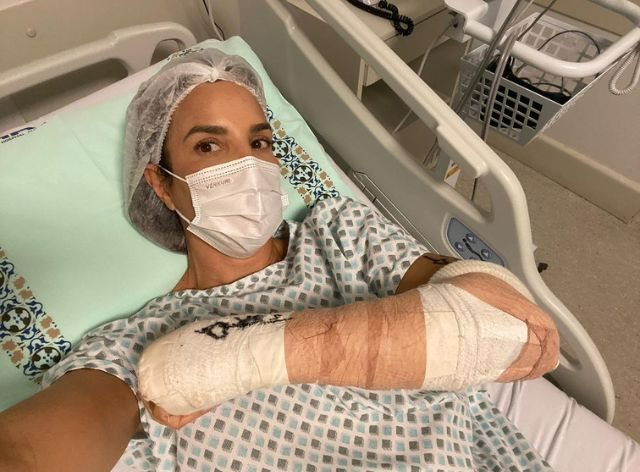 Ivete Sangalo quebra o punho durante viagem ao Chile: "Dor insuportável"
