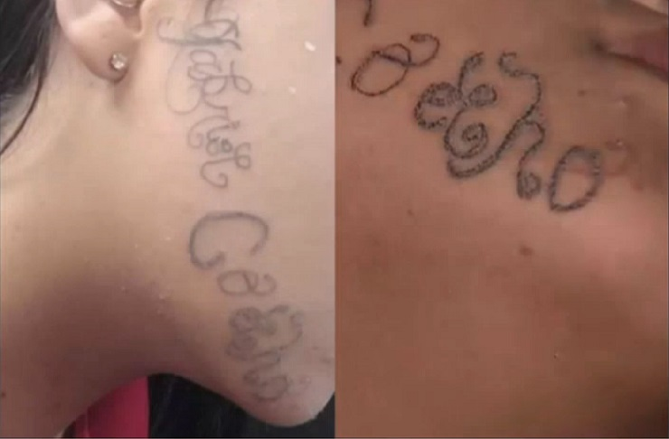 Jovem que teve rosto tatuado com nome de ex foi vítima de agressões recorrentes 