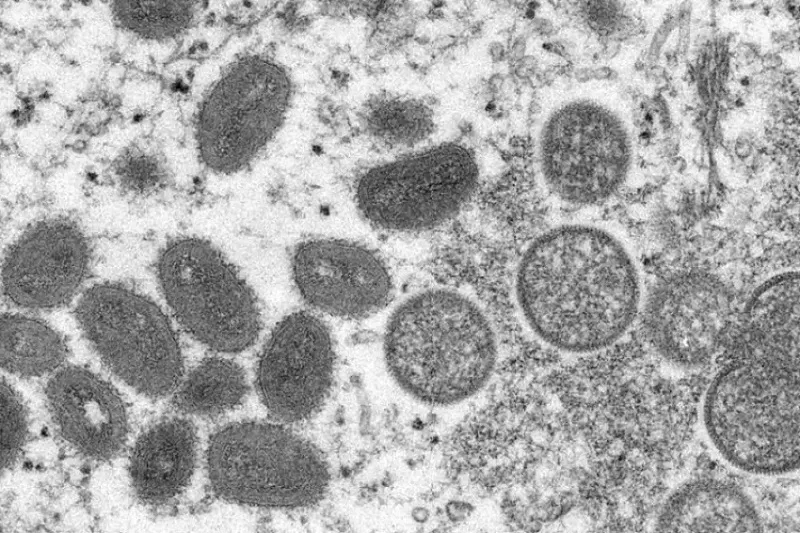 Paraná e DF registram caso de varíola do macaco