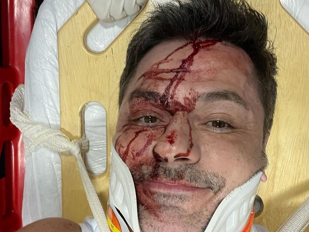 Irmão do Rodrigo Faro sofre acidente de carro: ''Nasci de novo''