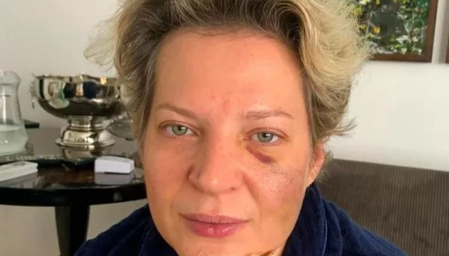 Joice Hasselmann não lembra das agressões, mas afirma que acordou em uma poça de sangue. Foto: Reprodução/Instagram