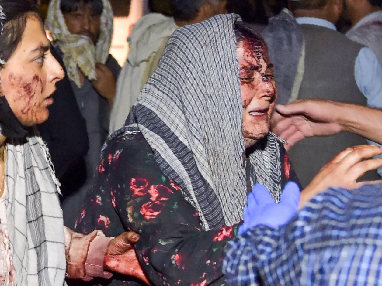 Mulher ferida chega ao hospital depois das duas explosões desta quinta-feira perto do aeroporto de Cabul