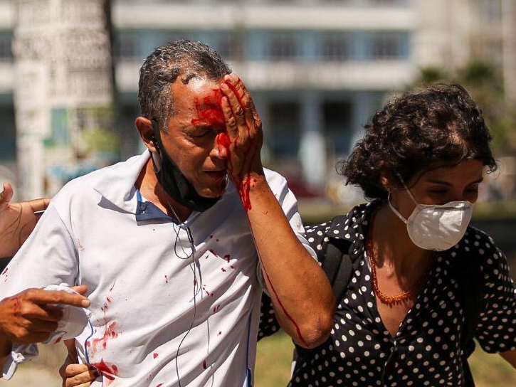 Homens feridos em manifestação vão ser indenizados pelo Governo de Pernambuco Hugo Muniz