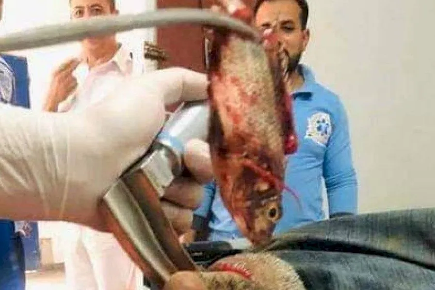 Fotos e vídeo mostram médico extraindo peixe vivo da garganta de um pescador
