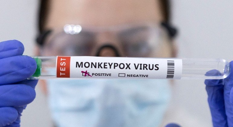 Outras suspeitas de varíola dos macacos no Brasil são monitoradas.