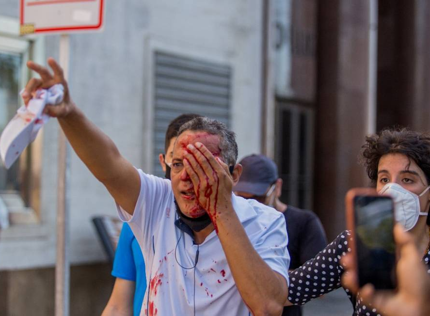 Homem atingido por bala de borracha em manifestação contra Bolsonaro no Pernambuco Foto: Reuters / Hugo Muniz